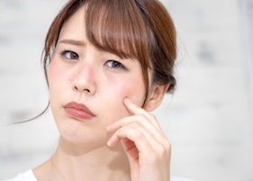 本格的な夏の前に知りたい！紫外線による肌ダメージと日焼け対策