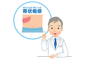 体の片側がピリピリしたら…知っておきたい帯状疱疹の話